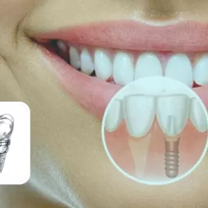  Предпочитаете посещать стоматолога без боли и дискомфорта?
